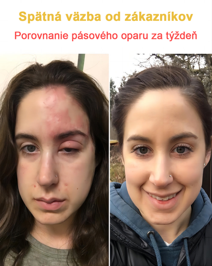 2024 NOVINKA Velisse™ Pleťový krém s včelím jedom(🧑‍⚕️Odporúča sa AAD), na odstránenie bradavíc, akné a jaziev – lieči viaceré kožné stavy