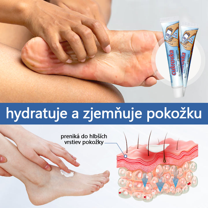 Krém na liečbu cukrovky Biancat® VitaGluco