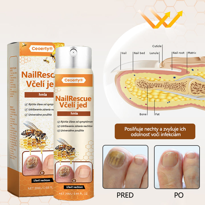 2025🎁 Limitovaná akcia 70% ZĽAVA ️ ️⏳ Ceoerty® Sprej na nechtovú hubu s včelím jedom 💥 Oprava všetkých problémov s nechtami do 2 týždňov