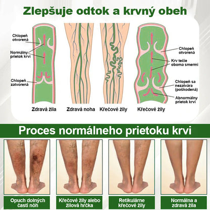 🌿🌿🌿Dorina® Bylinný krém na zmiernenie opuchov s čiernou rascou.