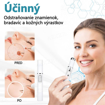 Bikenda®🎁 Neinvazívne laserové pero na odstránenie znamienok a bradavíc