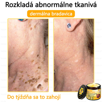 🌿 VLSVLS™ Regeneračný pleťový krém s včelím jedom 🐝 – Obnova ✨ Hydratácia 💧 Omladenie 💫