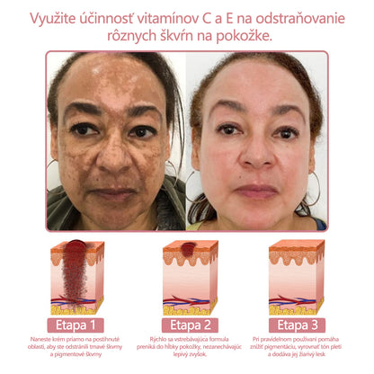 Krém na pleťskolagénom akoenzýmom Q10 v gélovej forme, schválený Slovenskou dermatologickou spoločnosťou (pomáha pri liečbe akné, bradavíc, ružovky, psoriázy, stareckých škvŕn, ekzémov a znižuje výskyt strií).