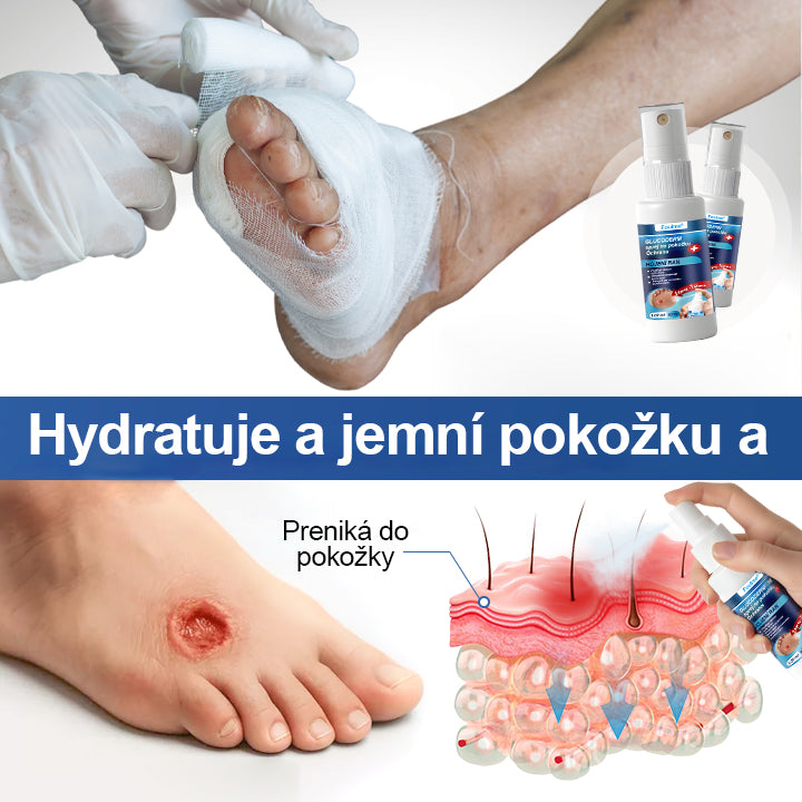 Foulme®  GlucoDerm Ochranný Sprej 🎄❄️Vianočná edícia – jemná starostlivosť o pokožku počas sviatkov ✨