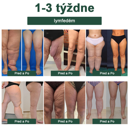 Zostáva iba 5 pohárov! Ponúkame Vám dodatočnú zľavu 50%! Získajte zdravé telo. Ak vám chýba teraz, dostanete ho až budúci rok.