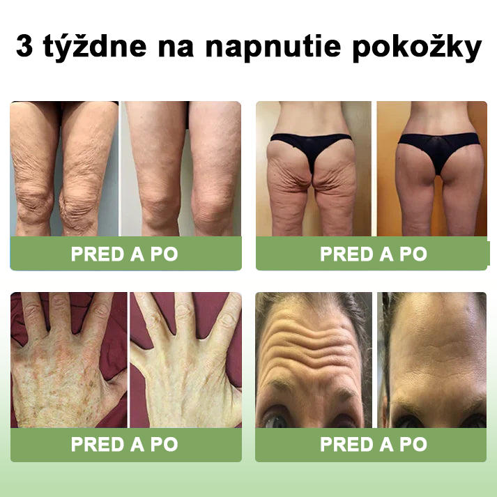 𝐒𝐓𝐃𝐄𝐈™ Kolagénový spevňujúci krém (🔥Časovo obmedzená zľava 74%!) 🏆