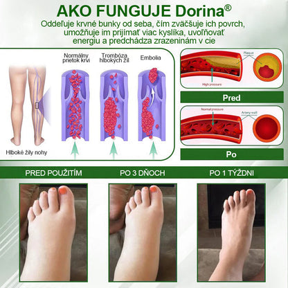 🌿🌿🌿Dorina® Bylinný krém na zmiernenie opuchov s čiernou rascou.