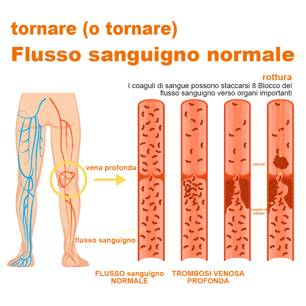 🏆[✨Negozio ufficiale del marchio✨]Zoencgz™ Crema al veleno d'api  per artrite e vene varicose