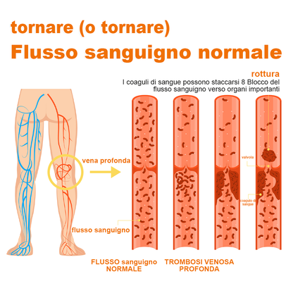 🏆[✨Negozio ufficiale del marchio✨]Zoencgz™ Crema al veleno d'api  per artrite e vene varicose