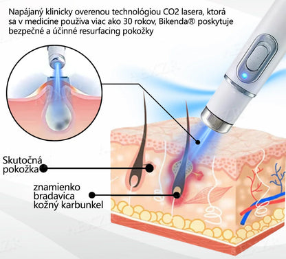 Bikenda®🎁 Neinvazívne laserové pero na odstránenie znamienok a bradavíc