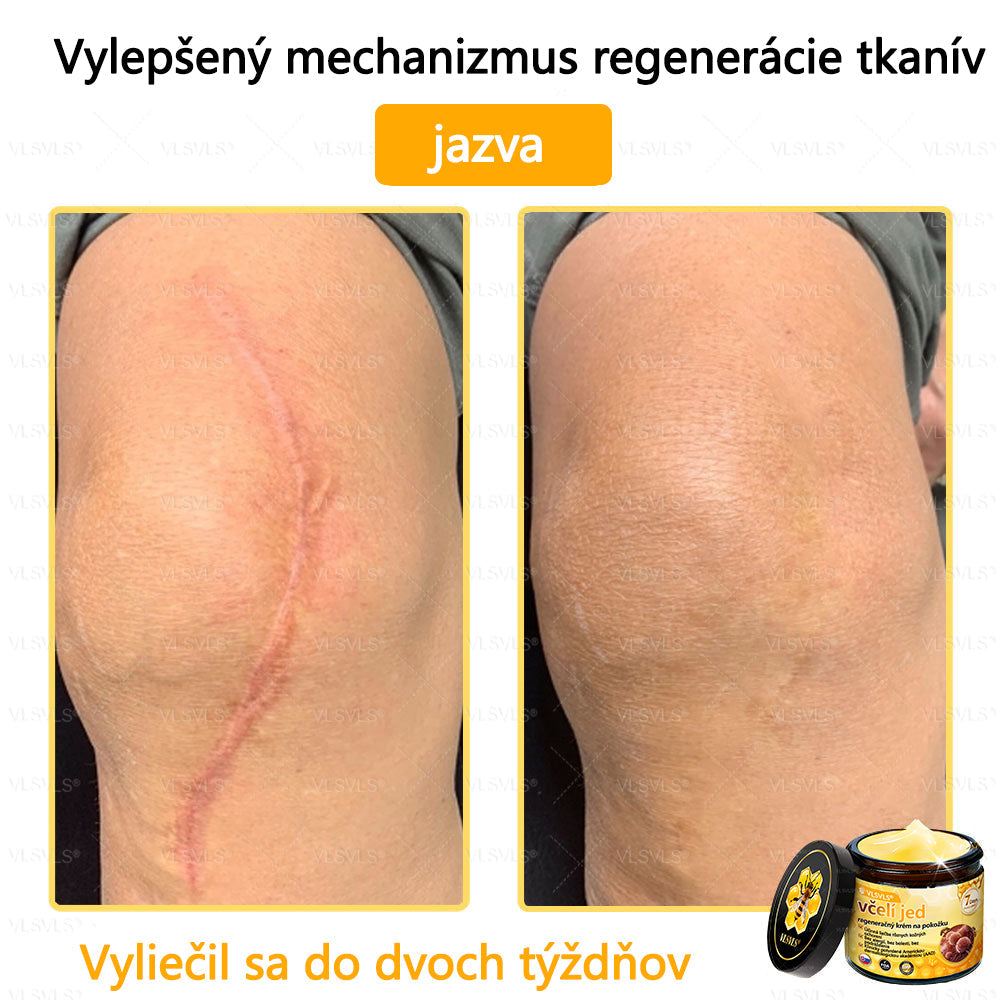 🌿 VLSVLS™ Regeneračný pleťový krém s včelím jedom 🐝 – Obnova ✨ Hydratácia 💧 Omladenie 💫