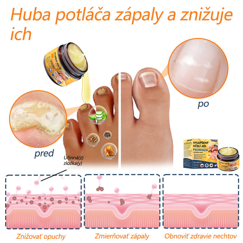 🌿Pokročilá masť na liečbu psoriázy Ourlyard™ (👨‍⚕Odporúčané lekárom) je certifikovaná Slovenským ústavom liečiv a zdravotníckych pomôcok (BFARM) a získala certifikáciu CE.