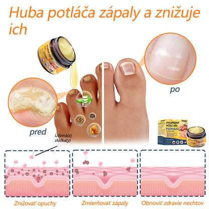 🌿Pokročilá masť na liečbu psoriázy Ourlyard™ (👨‍⚕Odporúčané lekárom) je certifikovaná Slovenským ústavom liečiv a zdravotníckych pomôcok (BFARM) a získala certifikáciu CE.