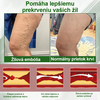 🌿🌿🌿Dorina® Bylinný krém na zmiernenie opuchov s čiernou rascou.