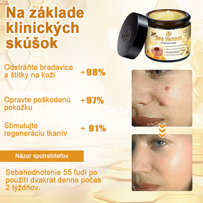 🏵️[Oficiálny vlajkový obchod] 𝑻𝒖𝒓𝒐𝒏𝒖™ Krém na ošetrenie pleti s včelím jedom (👨‍⚕𝐀𝐀𝐃 ODPORÚČANIA)