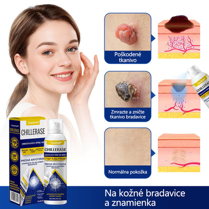 ❄️Foulme® ChillErase obnovujúci sprej proti kožným výrastkom