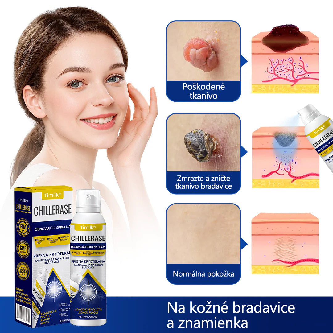 ❄️Timilk® ChillErase obnovujúci sprej proti kožným výrastkom