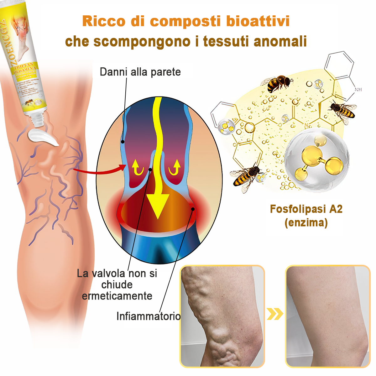 🏆[✨Negozio ufficiale del marchio✨]Zoencgz™ Crema al veleno d'api  per artrite e vene varicose