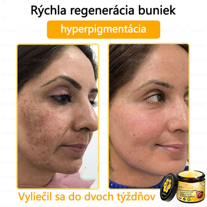 🌿 VLSVLS™ Regeneračný pleťový krém s včelím jedom 🐝 – Obnova ✨ Hydratácia 💧 Omladenie 💫
