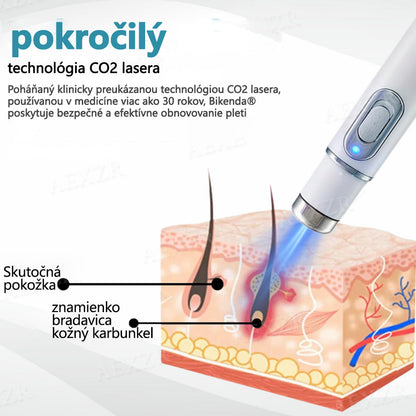 Bikenda®🎁 Neinvazívne laserové pero na odstránenie znamienok a bradavíc