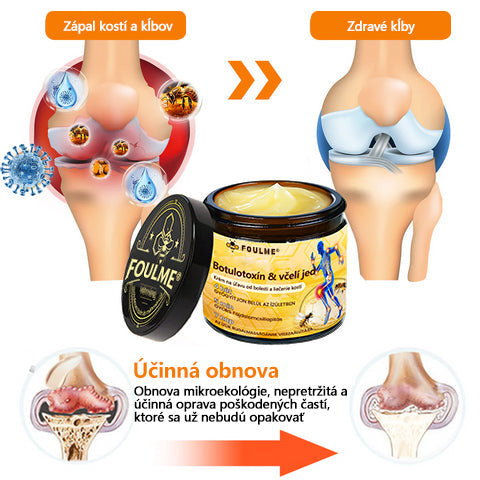 Foulme® Krém na hojenie kostí s botulotoxínom a včelím jedom ⭐👨‍⚕️