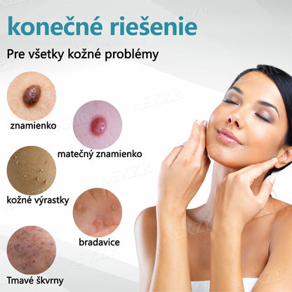 Bikenda®🎁 Neinvazívne laserové pero na odstránenie znamienok a bradavíc