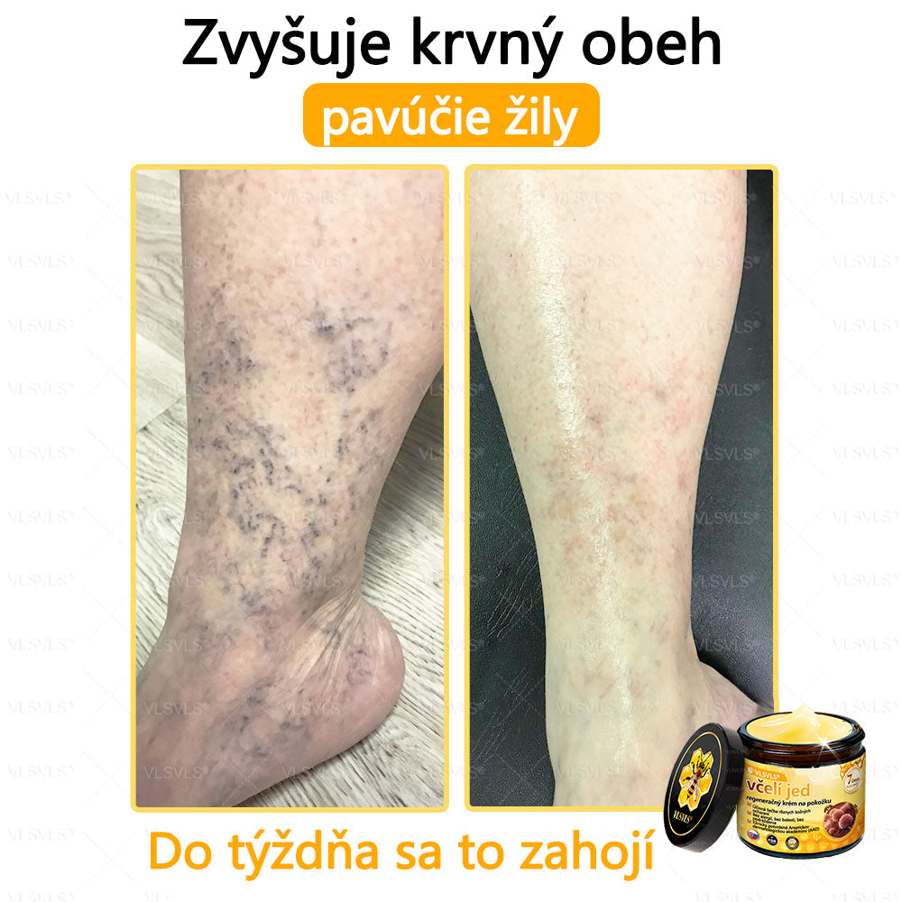 🌿 VLSVLS™ Regeneračný pleťový krém s včelím jedom 🐝 – Obnova ✨ Hydratácia 💧 Omladenie 💫