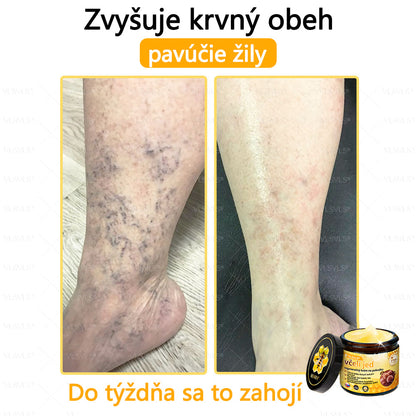 🌿 VLSVLS™ Regeneračný pleťový krém s včelím jedom 🐝 – Obnova ✨ Hydratácia 💧 Omladenie 💫