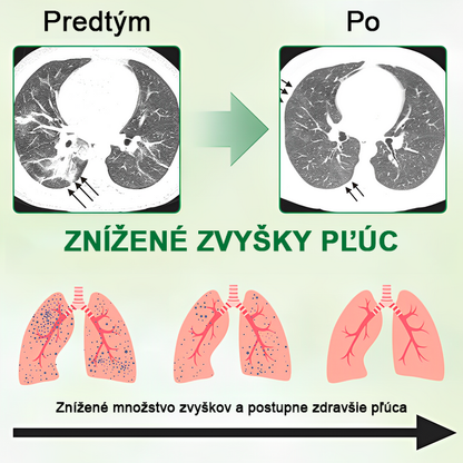 [Oficiálny značkový obchod] 👨‍⚕️𝐌𝐈𝐐𝐈𝐊𝐎® Pokročilý sprej na čistenie pľúc (☘️Odporúčané pľúcnymi špecialistami☘️)