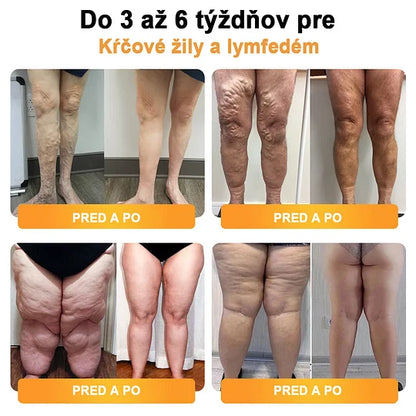 ⌚Detoxikačný náramok s ultrazvukovým odbúravaním tukov a diaľkovým infračerveným žiarením pre vyrovnávanie hladiny cukru v krvi - Energy Balance 🔥časovo obmedzená ponuka🔥