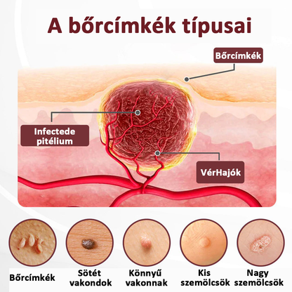 🔥🔥Biancat®KeraErase regeneračný krém s dvojitým účinkom