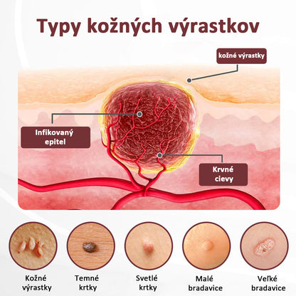 🔥🔥Biancat®KeraErase regeneračný krém s dvojitým účinkom