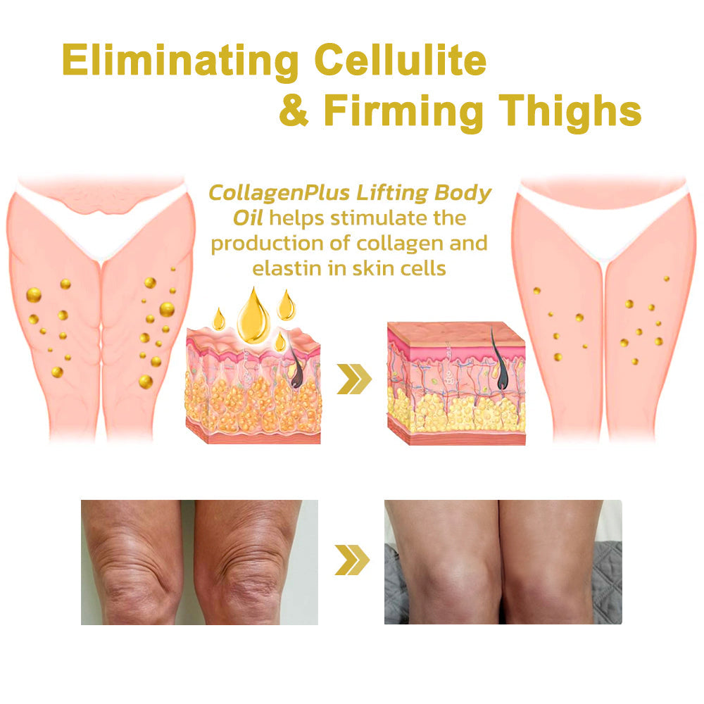 💖🥳Flysmus™ krém na odstránenie vrások, riešenie krepovatenia a ochabnutia (🔥74% zľava na obmedzený čas!)