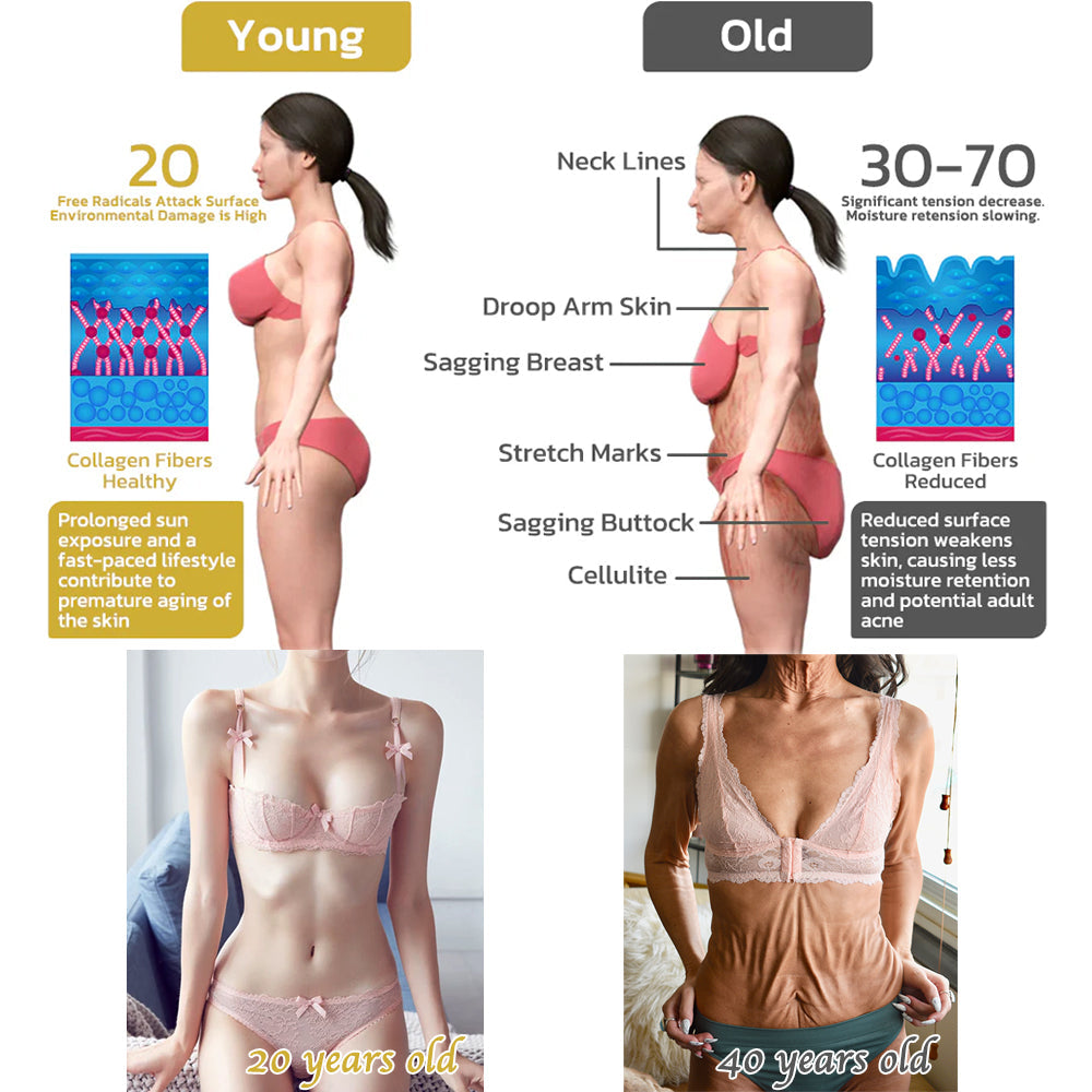 💖🥳Flysmus™ krém na odstránenie vrások, riešenie krepovatenia a ochabnutia (🔥74% zľava na obmedzený čas!)